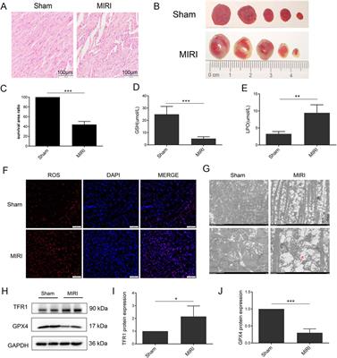 Inhibition of Sat1 alleviates myocardial ischemia-reperfusion injury through regulation of ferroptosis via MAPK/ERK pathway